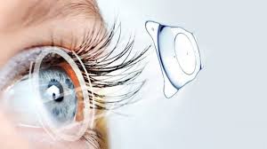 Akıllı Lens (Trifokal Göz İçi Mercek): Net Görüşte Yeni Dönem